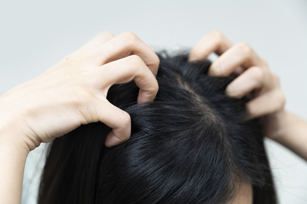 Home Remedies For Itchy Scalp