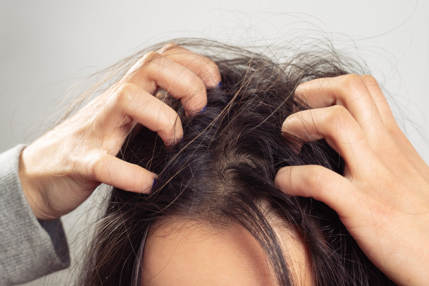 Home Remedies For Itchy Scalp