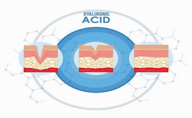 Hyaluronic acid